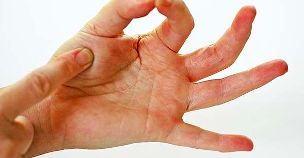 parmak-et-testi