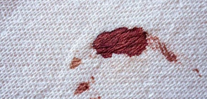 Featured image of post Giyim, Halı, Mobilyadan Kan Lekesi Nasıl Çıkarılır?