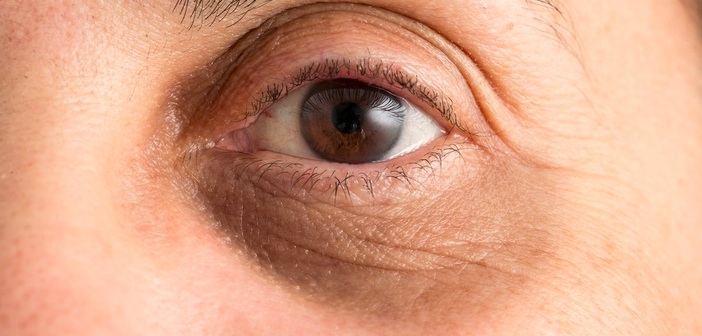 Featured image of post Göz Altınız Kalıtımsal Olarak Koyu İse