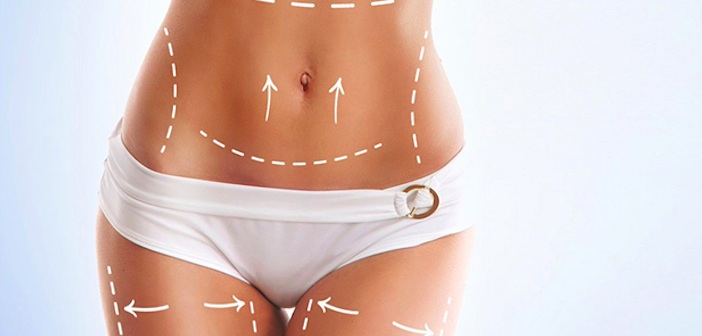 Featured image of post İnatçı Kilolara Veda Etmenin Mucizevi Formülü: Liposuction