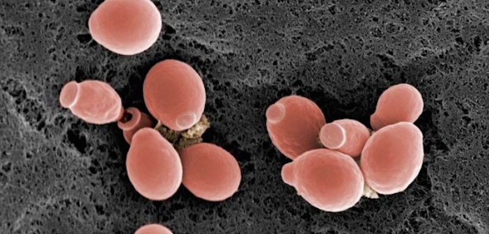 Featured image of post Candida Diyeti Nedir? Candida Diyeti Nasıl Yapılır?