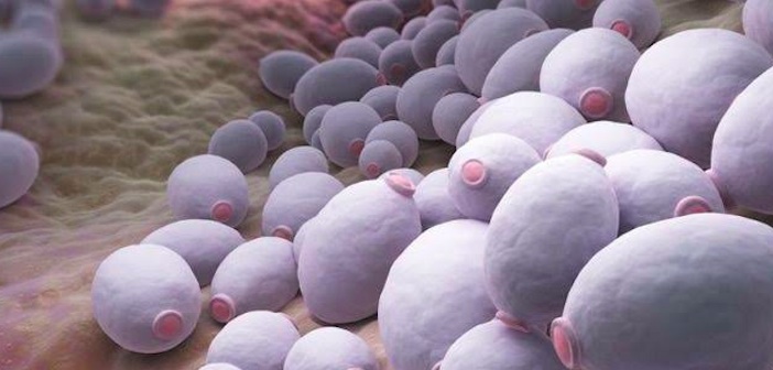 Featured image of post Candida Nedir? Belirtileri Nelerdir?