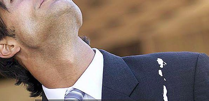 Featured image of post Giysilerden Kuş Pislikleri Nasıl Çıkarılır?